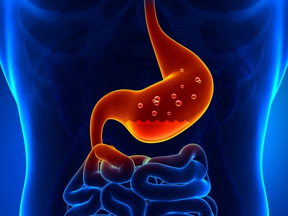 Gastritis is an inflammatory disease of the stomach that requires nutrition